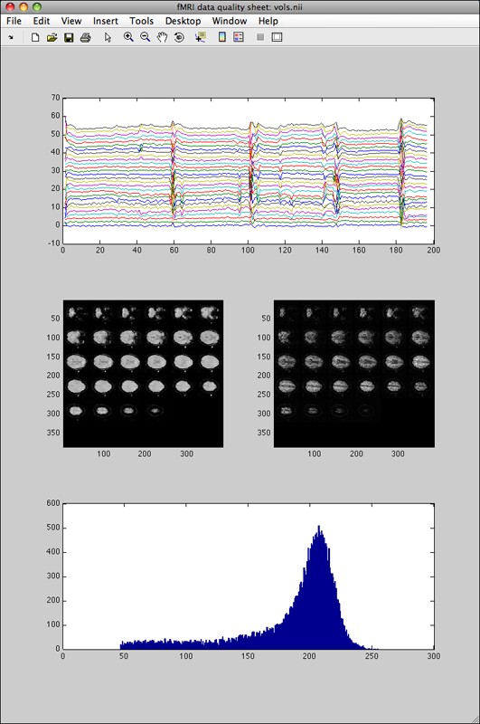 fmriqasheet output for a call to fmriquality without motion parameters detection