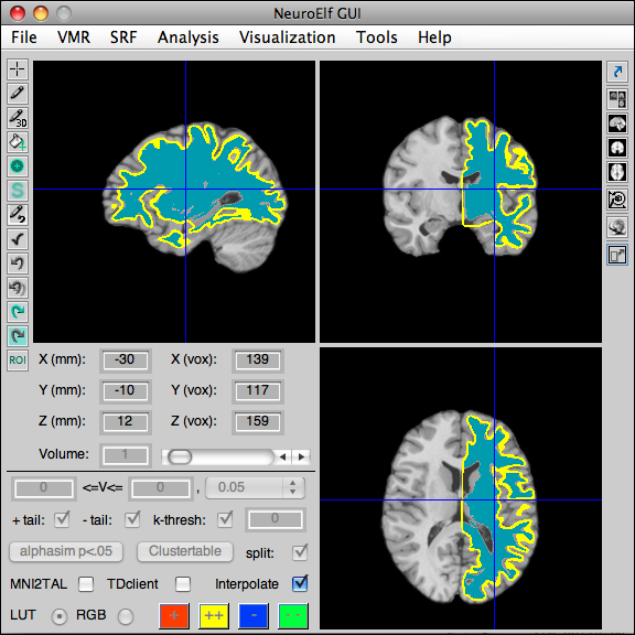 srf_backtovmr_sample.png srf_backtovmr_sample.png