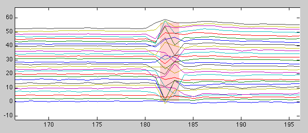 fmriqasheet_womotion_tczoom.png fmriqasheet_womotion_tczoom.png