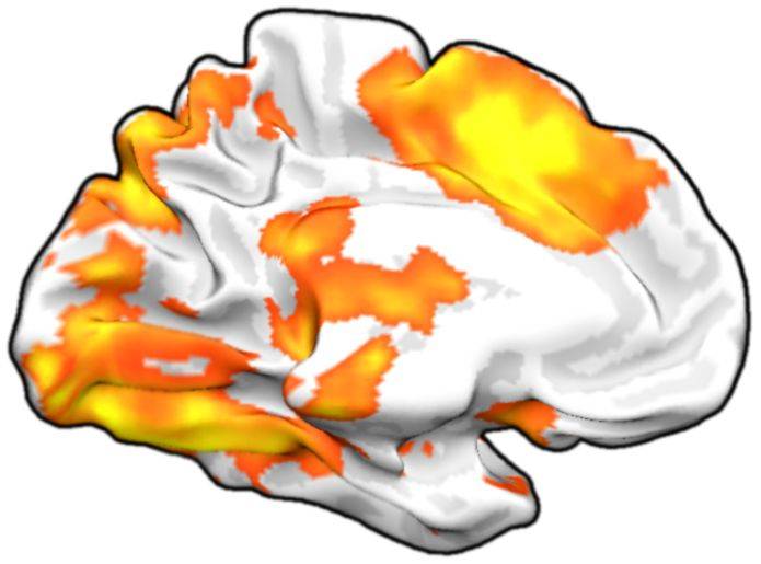 surfaceprojection_sample.jpg surfaceprojection_sample.jpg