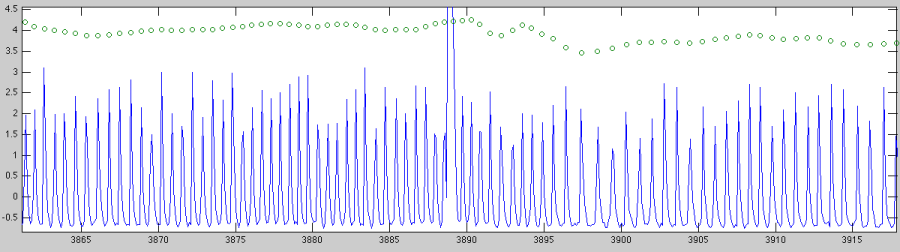 ecg_and_hr_zoomed.png ecg_and_hr_zoomed.png