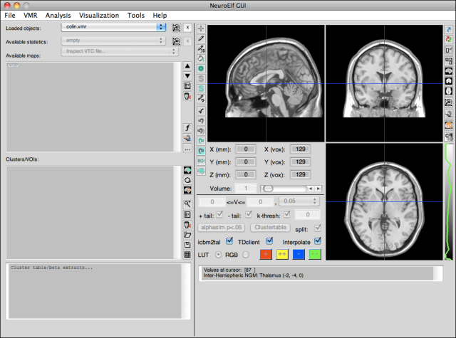 NeuroElf Viewer (full mode, no stats)