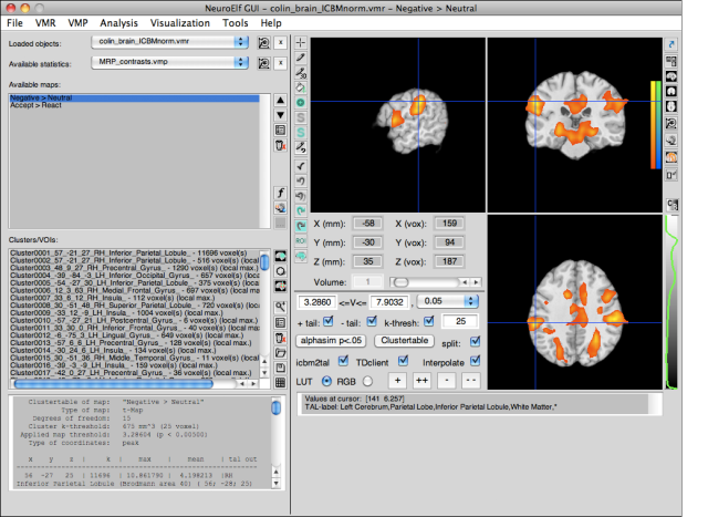 NeuroElf GUI (full mode with stats)